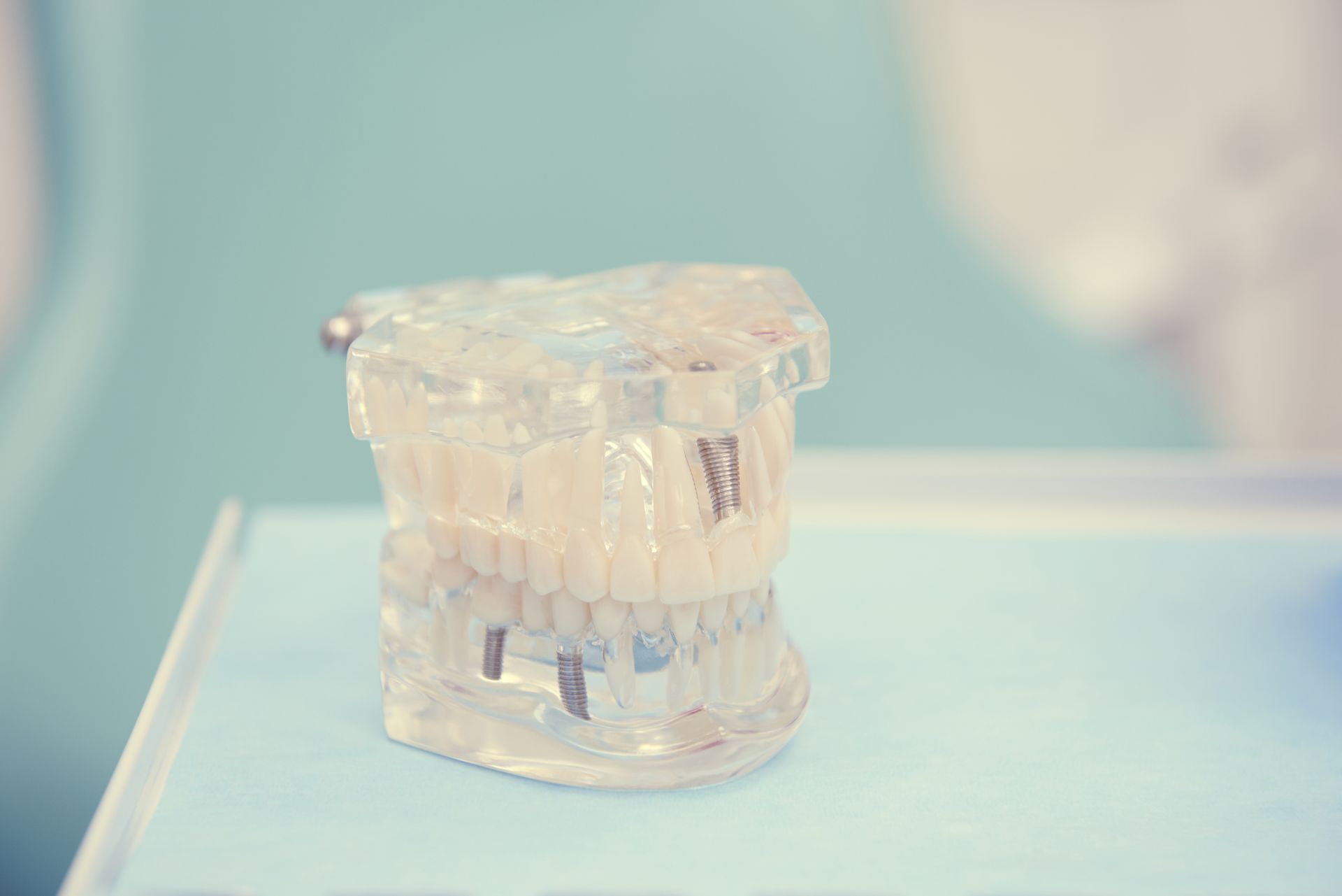 dental madrid 23 mejores implantes dentales en Villalba